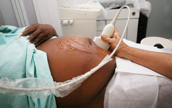 Casos de HIV em grávidas negras e pardas aumentou 64,4% em dez anos | Foto: Mateus Pereira/GOVBA